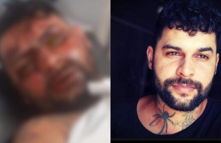 ‘Me recuperando dos traumas’, diz tatuador que perdeu olho após ser atingido por ácido