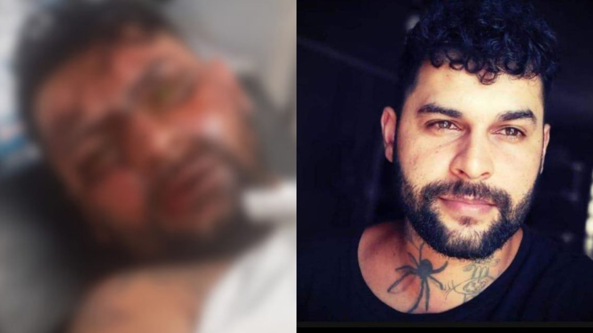 ‘Me recuperando dos traumas’, diz tatuador que perdeu olho após ser atingido por ácido